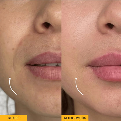 Gua Sha Brush for Snatched Face